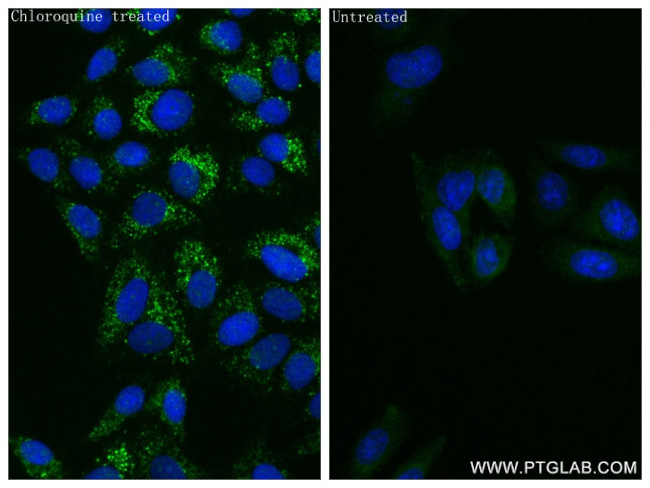 ATG8L Antibody in Immunocytochemistry (ICC/IF)