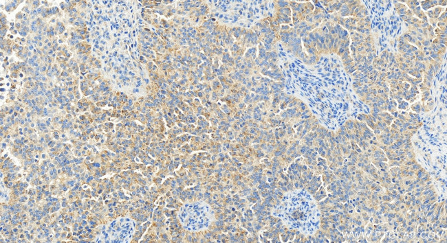 GADD45GIP1 Antibody in Immunohistochemistry (Paraffin) (IHC (P))