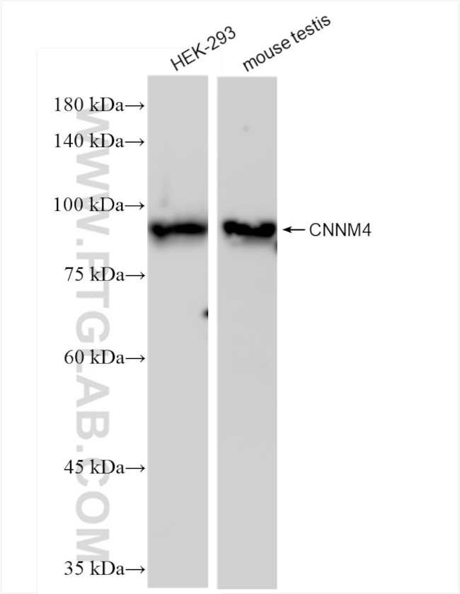 CNNM4 Antibody in Western Blot (WB)