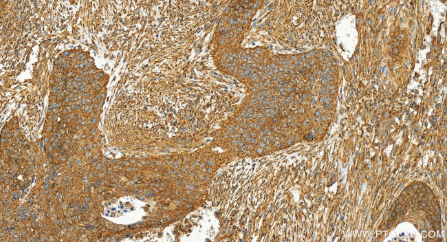 ALDH1A1 Antibody in Immunohistochemistry (Paraffin) (IHC (P))
