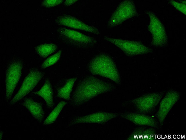 SMAD2 Antibody in Immunocytochemistry (ICC/IF)