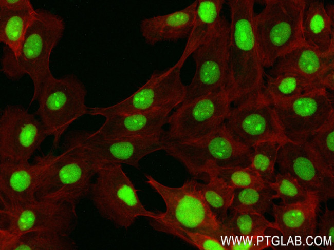 TRMT6 Antibody in Immunocytochemistry (ICC/IF)