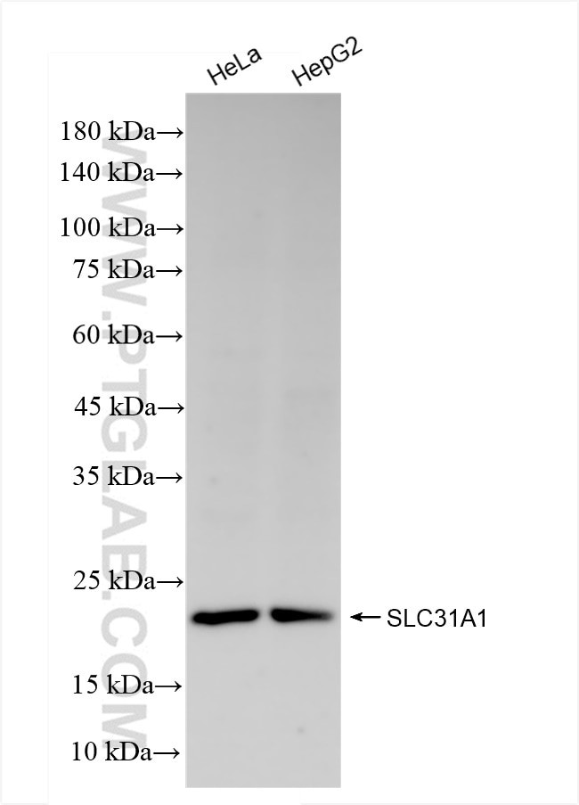 SLC31A1 Antibody in Western Blot (WB)