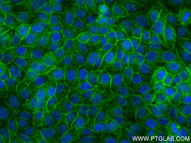 SLC31A1 Antibody in Immunocytochemistry (ICC/IF)