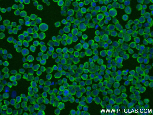 CYFIP2 Antibody in Immunocytochemistry (ICC/IF)