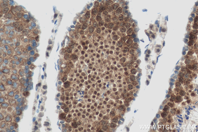 USP53 Antibody in Immunohistochemistry (Paraffin) (IHC (P))