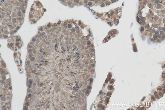 IQUB Antibody in Immunohistochemistry (Paraffin) (IHC (P))