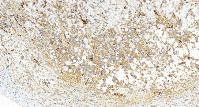 PTPN12 Antibody in Immunohistochemistry (Paraffin) (IHC (P))