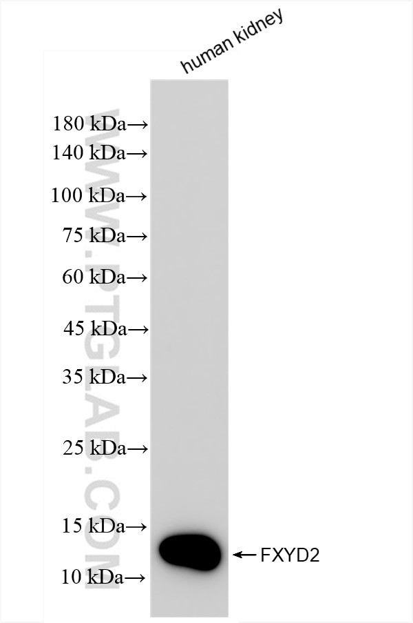 FXYD2 Antibody in Western Blot (WB)