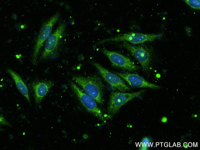 FAM127B Antibody in Immunocytochemistry (ICC/IF)