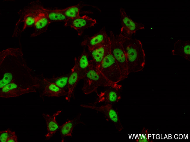 FIP1L1 Antibody in Immunocytochemistry (ICC/IF)