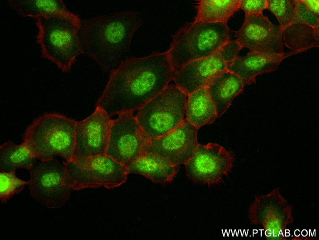 Loricrin Antibody in Immunocytochemistry (ICC/IF)