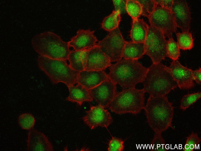 Thyroid Hormone Receptor beta Antibody in Immunocytochemistry (ICC/IF)
