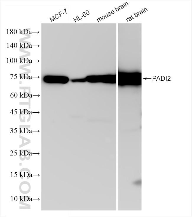PADI2 Antibody in Western Blot (WB)