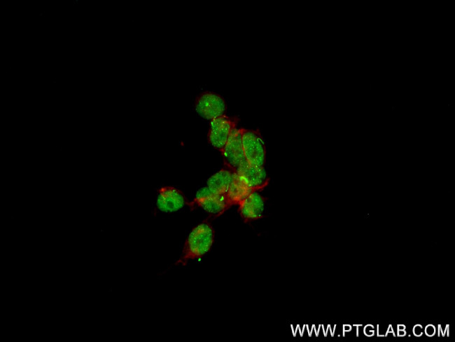 PRDM16 Antibody in Immunocytochemistry (ICC/IF)