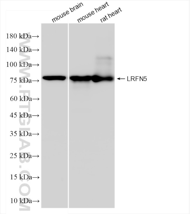 LRFN5 Antibody in Western Blot (WB)