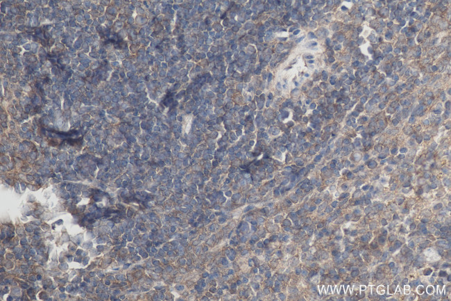CD40L/CD154 Antibody in Immunohistochemistry (Paraffin) (IHC (P))