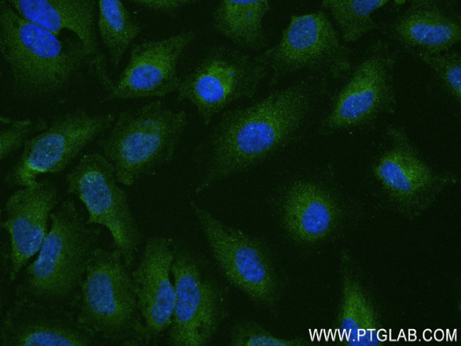 UBAP2 Antibody in Immunocytochemistry (ICC/IF)