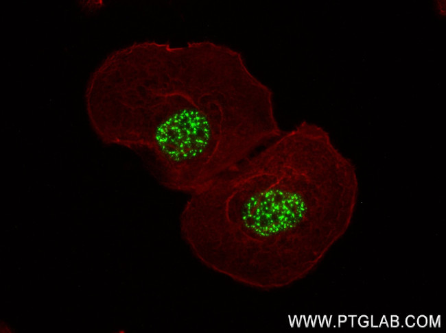 ETV4 Antibody in Immunocytochemistry (ICC/IF)