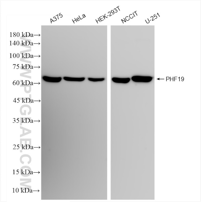 PHF19 Antibody in Western Blot (WB)