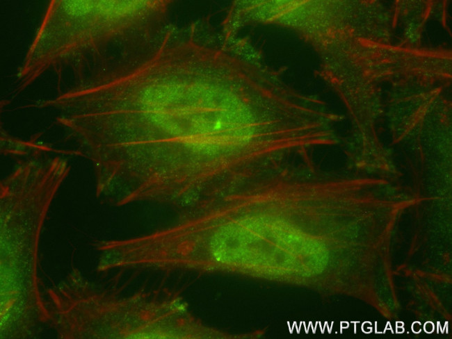 VPRBP Antibody in Immunocytochemistry (ICC/IF)