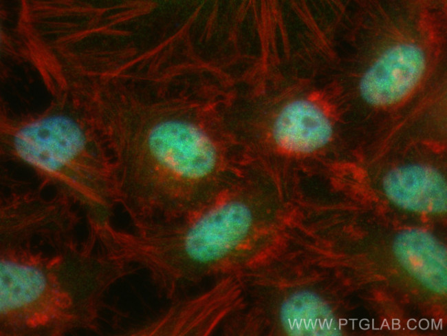 VPRBP Antibody in Immunocytochemistry (ICC/IF)