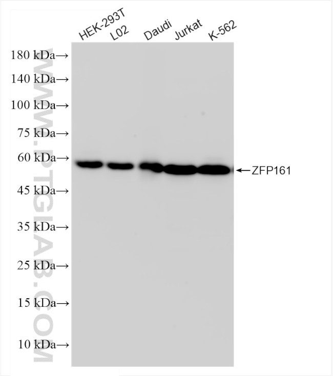 ZFP161/ZBTB14 Antibody in Western Blot (WB)