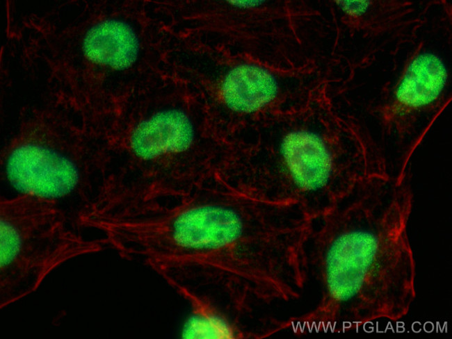 ZFP161/ZBTB14 Antibody in Immunocytochemistry (ICC/IF)