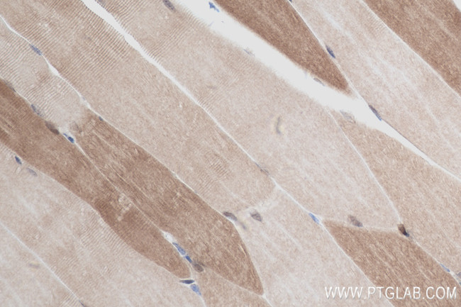 FBP2 Antibody in Immunohistochemistry (Paraffin) (IHC (P))