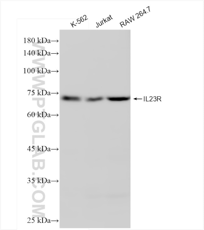 IL23R Antibody in Western Blot (WB)