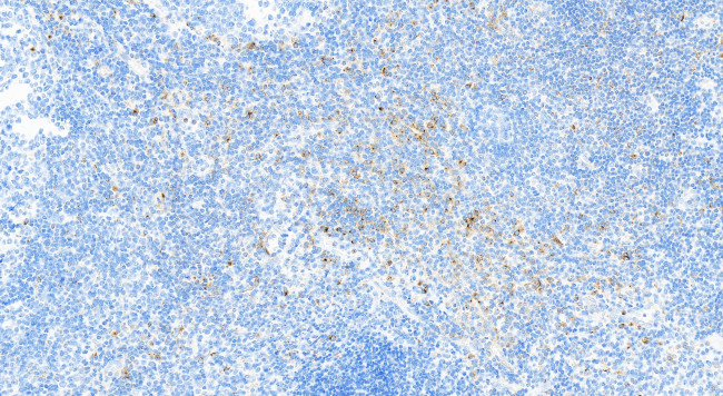 VISTA Antibody in Immunohistochemistry (Paraffin) (IHC (P))