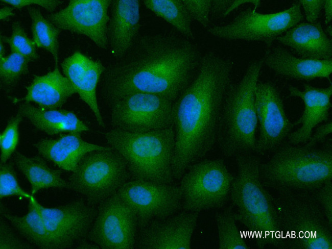 BUB1B Antibody in Immunocytochemistry (ICC/IF)