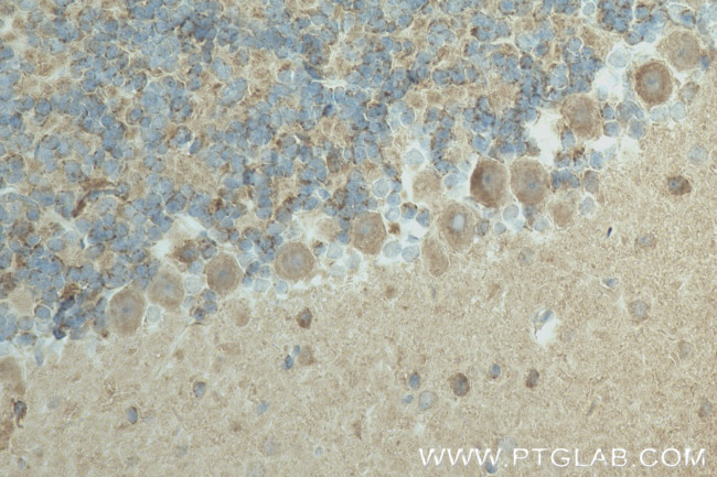 Synaptotagmin-14 Antibody in Immunohistochemistry (Paraffin) (IHC (P))