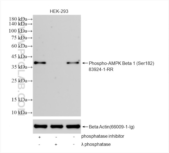 Phospho-AMPK Beta 1 (Ser182) Antibody in Western Blot (WB)