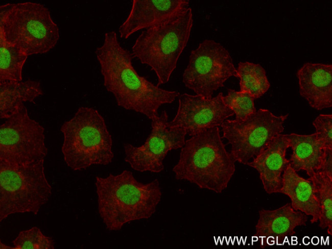 FOXO6 Antibody in Immunocytochemistry (ICC/IF)