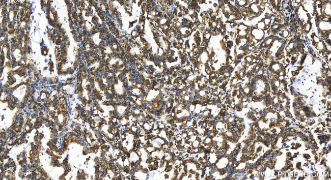 RPL18A Antibody in Immunohistochemistry (Paraffin) (IHC (P))
