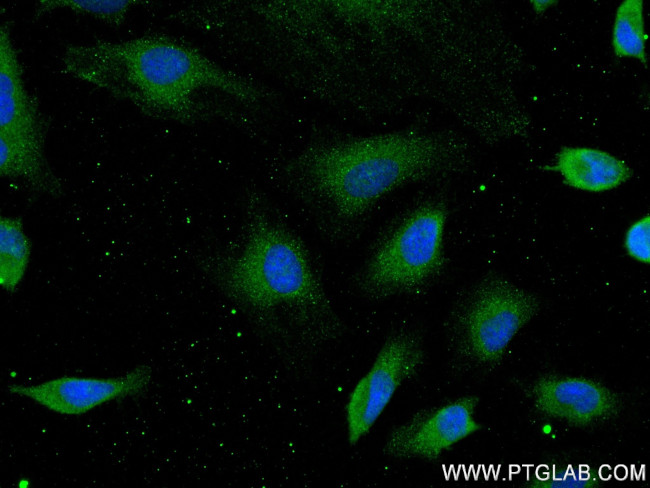 ANXA5 Antibody in Immunocytochemistry (ICC/IF)