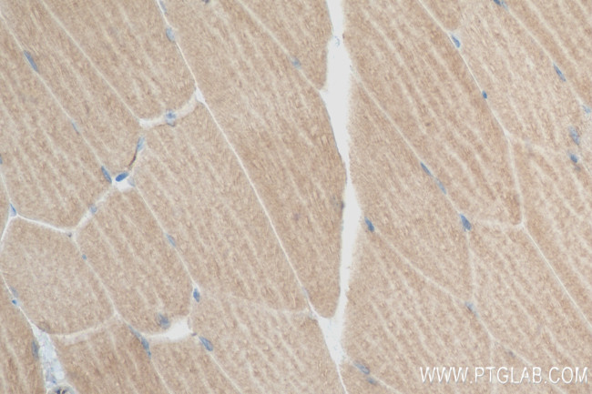 NEU2 Antibody in Immunohistochemistry (Paraffin) (IHC (P))