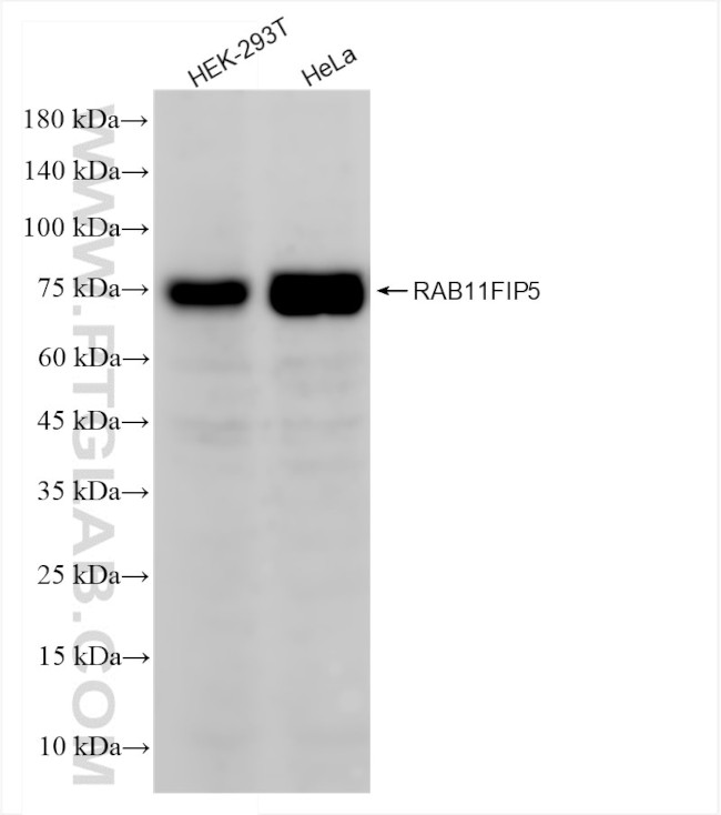 RAB11FIP5 Antibody in Western Blot (WB)