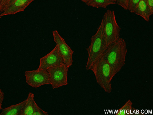 CXXC5 Antibody in Immunocytochemistry (ICC/IF)