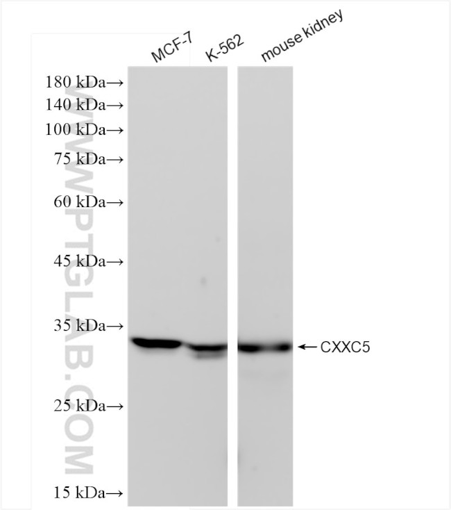 CXXC5 Antibody in Western Blot (WB)