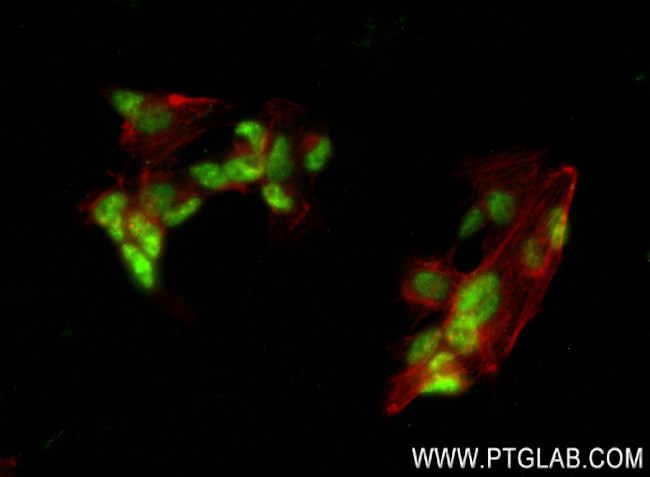 EOMES Antibody in Immunocytochemistry (ICC/IF)