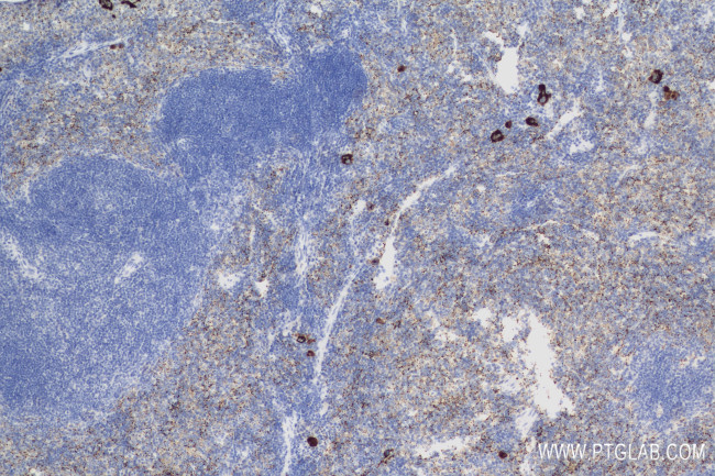 Selp/P-selectin Antibody in Immunohistochemistry (Paraffin) (IHC (P))