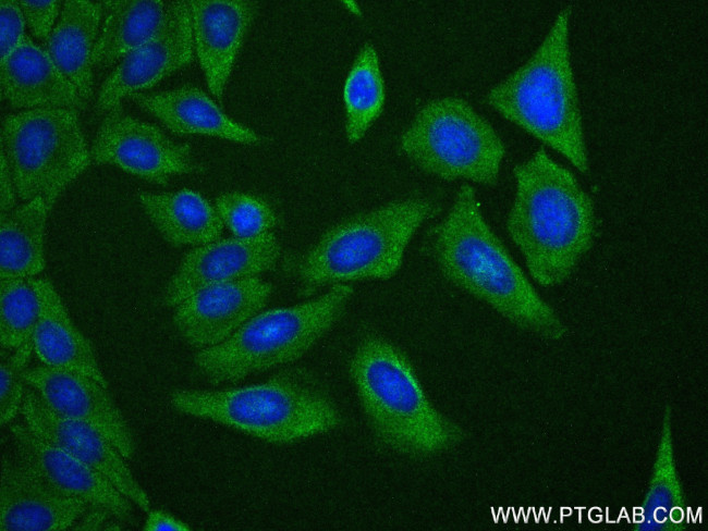 HSP90 Antibody in Immunocytochemistry (ICC/IF)