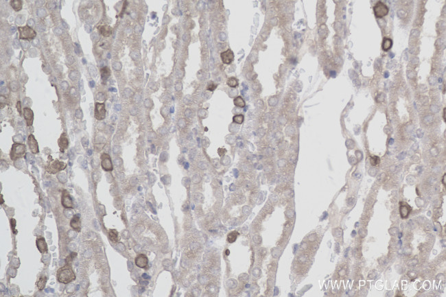 ATP6V1B1 Antibody in Immunohistochemistry (Paraffin) (IHC (P))