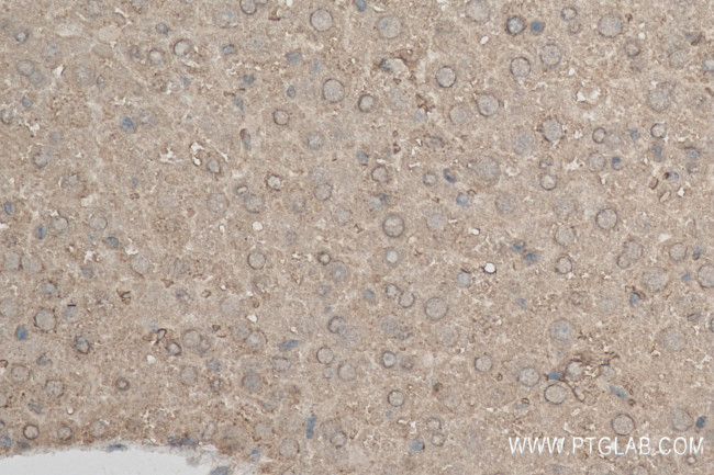 XBP1S Antibody in Immunohistochemistry (Paraffin) (IHC (P))