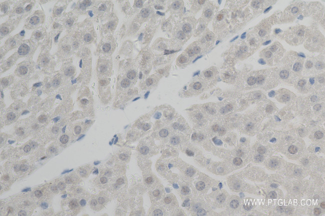 XBP1S Antibody in Immunohistochemistry (Paraffin) (IHC (P))
