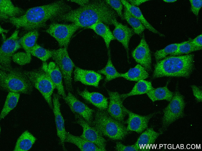 ADIPOQ Antibody in Immunocytochemistry (ICC/IF)