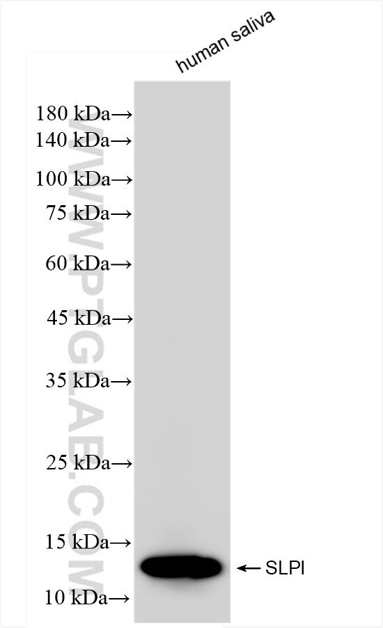 SLPI Antibody in Western Blot (WB)