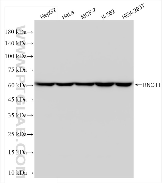 RNGTT Antibody in Western Blot (WB)